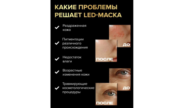 Рейтинг лучших аппаратов для LED-терапии на 2025 год