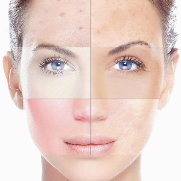 Лучшие средства и кремы при обветривании лица на 2026 год Лучшие средства и кремы при обветривании лица на 2026 год